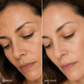 Bild in Galerie-Betrachter laden, MedandSkin Pigment Correction Set | Anti Pigmentflecken