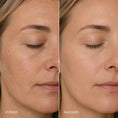 Bild in Galerie-Betrachter laden, Rejuvenate and Refine - Vitamin A Creme | MedandSkin